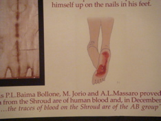 Analysis of feet and blood on the Shroud (hs)